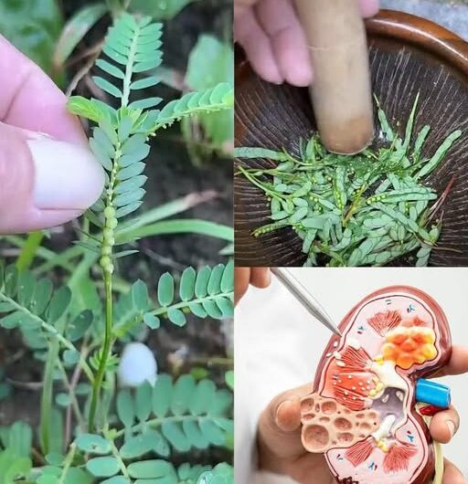 Diente de León: Un Aliado Natural Contra los Cálculos Renales