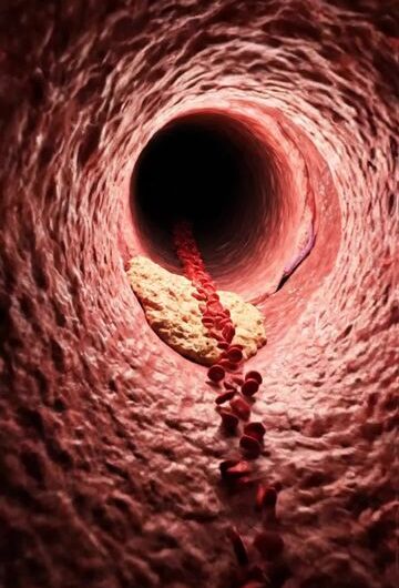 Tu cuerpo avisa antes del infarto