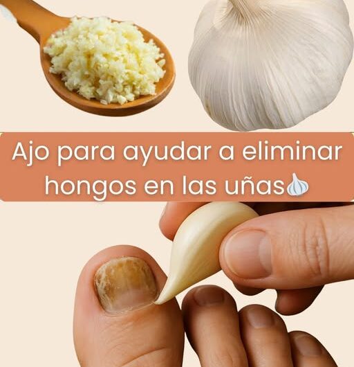 Receta natural de ajo para el cuidado de las uñas con hongos