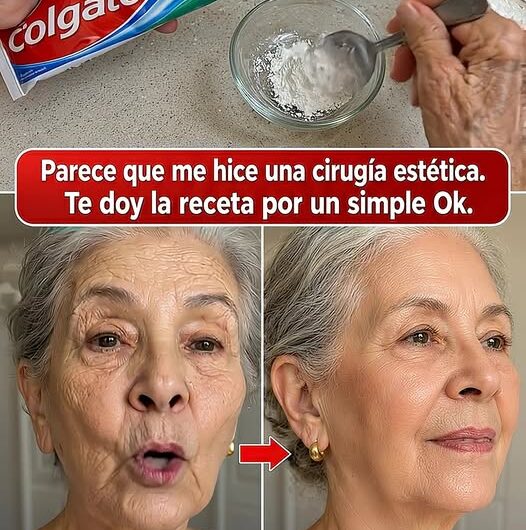 La Verdad Sobre la Pasta Dental en el Rostro y la Alternativa Natural para Secar el Acné de Forma Segura