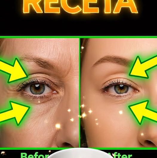 Cómo Hacer tu Propio Contorno de Ojos Natural para Combatir la Resequedad y las Líneas de Expresión