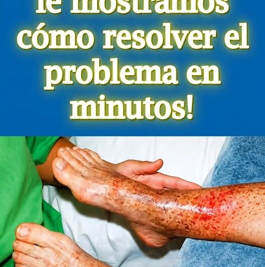 El Jugo Natural Definitivo para Mejorar la Mala Circulación y Aliviar las Piernas Pesadas