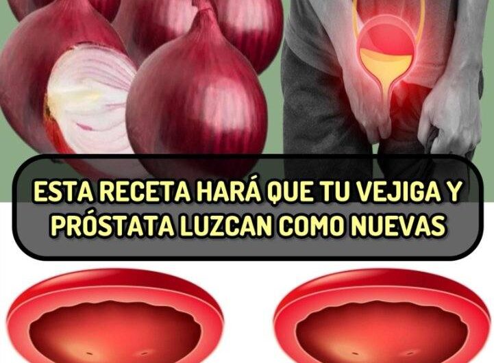 Recetas Naturales para la Vejiga y Próstata: Beneficios de la Cebolla